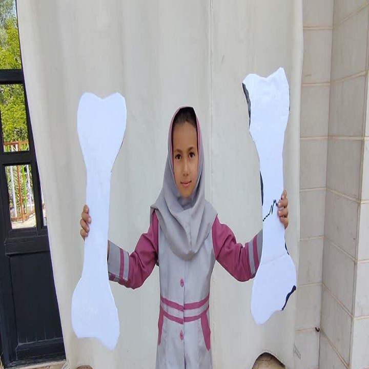 پوکی استخوان
